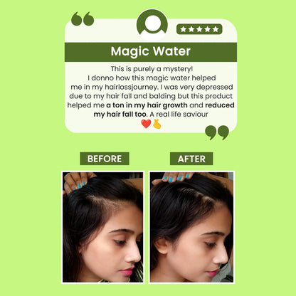 Premium Rosemary Water Spray | Hair Growth Booster | Anti Hair Fall Formula | Buy 1 Get 2 Free